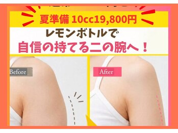 アン 銀座(ann)の写真/【夏準備キャンペーン】レモンボトル10cc
二の腕・背中・ハミ肉撃退 この夏見せたいボディへ19800円