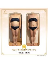 リンカ(Rinka.)/☆帯広初!!ハイパーナイフ導入☆