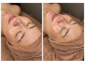 ムゥ(Mwoo)/ララピール/ララピール西宮