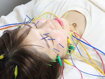 オリナ(olina)/人気NO.1美容鍼灸