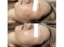 ラティア(Ratia)/