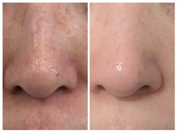 ミヤビ(miyabi)/ルネセル化粧品