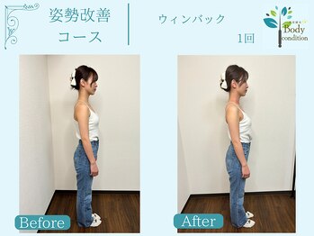 ボディコンディション/ウィンバック/痩身/小顔ラジオ波
