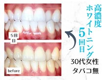 ルカノン(le canon)/写真撮るのが楽しいです(*^-^*)