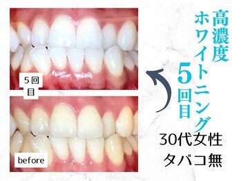 ルカノン(le canon)/写真撮るのが楽しいです(*^-^*)