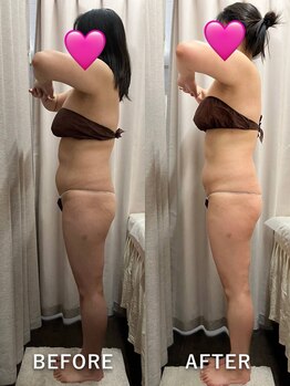 ベルミーランド MEGAドン・キホーテ草加/痩身Before→After