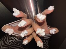 シーネイル(See.nail)/埋め込みネイル