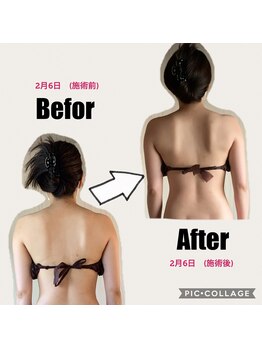 アンベリール(Embellir)/Before・After