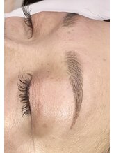 ヴィプラス(Vi+)/