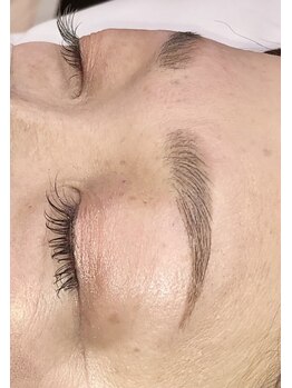 ヴィプラス(Vi+)/