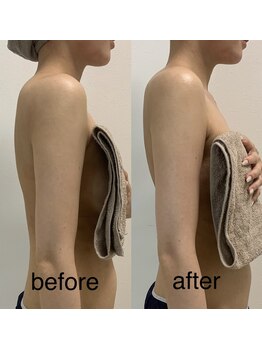 ニコ(25)/姿勢改善筋膜リリース