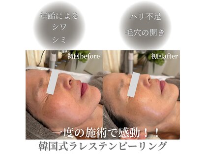 フィエルテ(Fielte)の写真