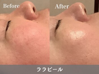 トウメイコガオ 横浜店/トウメイコガオ【ララピール】