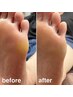 足裏がザラザラ《つるすべ足裏に》フットワンカラー+角質ケア 9,900→8,800