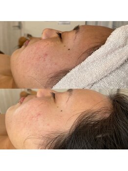 シグネット(Cygnet)/CHRISTINA/ビオフィート