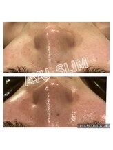 アユスリム(AYU SLIM)/毛穴ケアをしたい