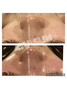 アユスリム(AYU SLIM)/毛穴ケアをしたい