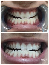 エクシアホワイトニング 石巻店/ホワイトニングサロン　石巻店