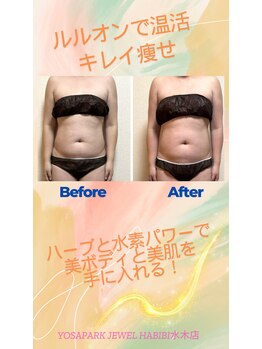 ヨサパーク ジュエル ハビビ 水木店(YOSA PARK JEWEL HABIBI)/お客様の施術後ボディ変化お写真