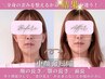 【中顔面短縮矯正】エラ/たるみ/コリ★頭蓋骨小顔＆全身×痩身マシン初回体験