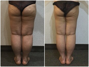 美容整体 ウェリナ 蟹江院/小顔矯正/骨盤矯正/美脚サロン