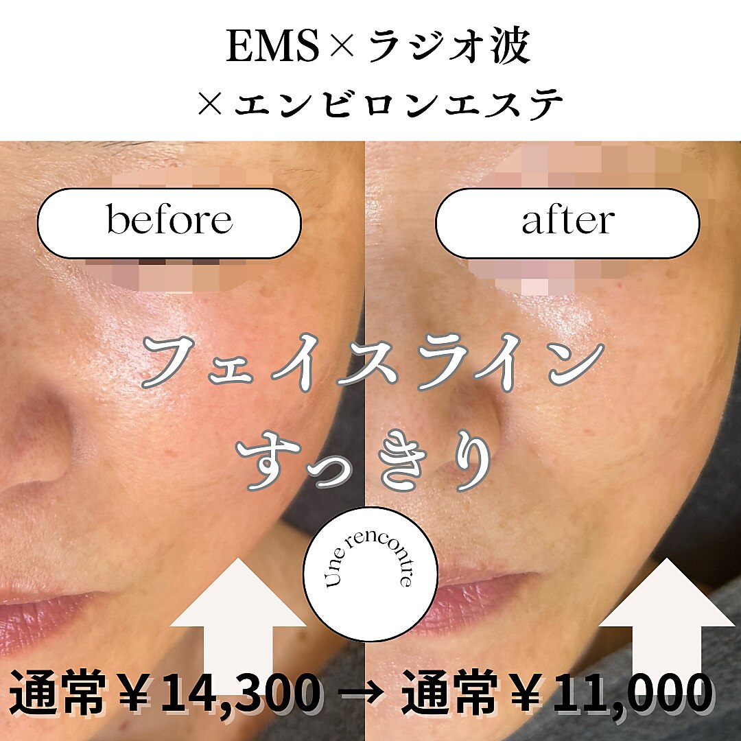 岐阜市でEMSが人気のエステサロン｜ホットペッパービューティー