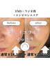 リフトアップ美肌ケア（EMS×ラジオ波×導入）たるみケアにお勧め！70分
