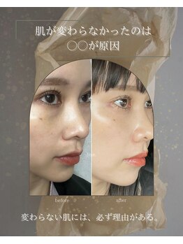 ヒュウ(hue.)/韓国発最新肌管理[セルマン]