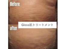 ブリランテ(Brillante)の雰囲気(グロス肌トリートメント!シワ、シミ、たるみを改善し艶肌へ!)