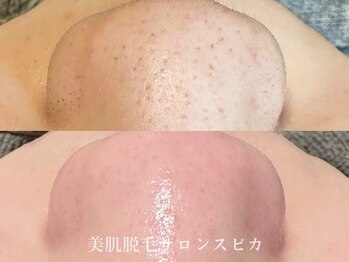 スピカ(SPICA)/必要なこと不必要なことの選択