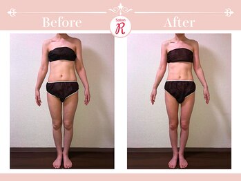 サロン アール(Salon R)/痩身施術×食事・インナーケア