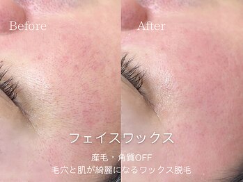 クラッシーブロウ 浦添/肌が綺麗になるフェイスワックス