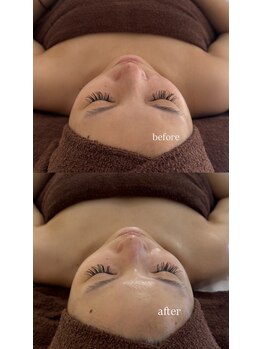 アルテ 神戸(Arte)/