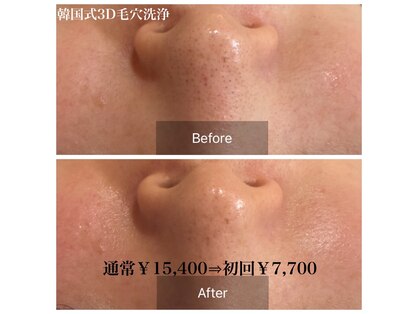 コンジュ(kongju)の写真