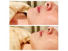 K.ステージの雰囲気(ツヤ肌ダブルハーブピーリングお肌お悩みに負担のかけない施術!)