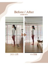 ティースリー 下北沢店(T-THREE)/前重心の立ち姿勢が改善！