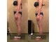 リンパケア顔筋美容のフフ(ff)の写真