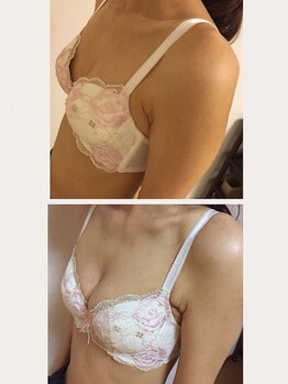 アンド ユー(and.yu)/★お客様症例★