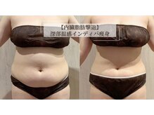 アイニティ ボディ トーニング 赤坂(INITY BODY TONING)の雰囲気（表面的な変化ではなく、根本から整えるサポートをします。）