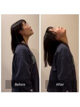 エスボディジャパン(S-BODY JAPAN)/肩こり改善例