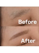 エムデコビューティ(M-DecoBeauty)/幅広い年齢に大好評