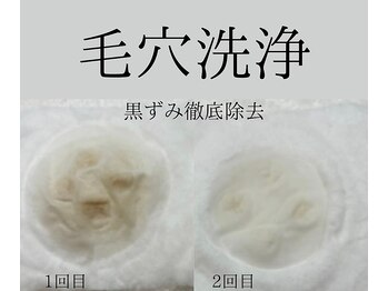 サロンドムーン(salon de MooN)/セルキュア４プラス美顔器