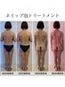 【極上！泡マッサージ】濃密ホイップ泡トリートメント¥13200→¥11000