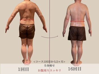 エル 麻布十番(LllL)/【メンズ痩身】3ヶ月で-8kg減量