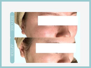 スリムライン 盛岡店(The Slim Line)/before→after