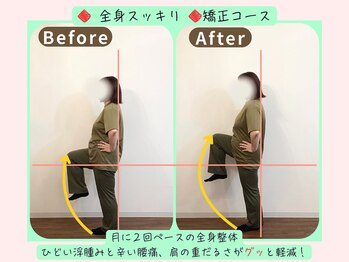 リフィール 国分寺店/Before&After【骨盤/姿勢/整体】