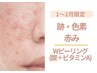 【跡/赤み】跡デトックス［Wピーリング（酸+ビタミンA)＋イオンorマッサ-ジ］