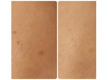 ヴィゴラスの雰囲気（シミケアでクリアな肌へ♪シミケア取り放題コースが大人気★）