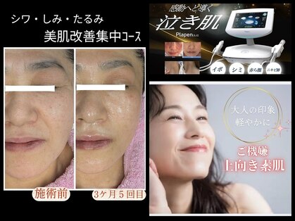 美 ウツクシ(美 U.tsu.ku.shi)の写真