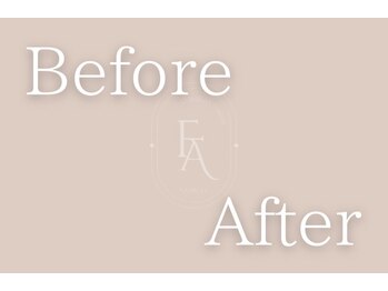 ファミーユ 豊橋店/【before after】インディバ効果
